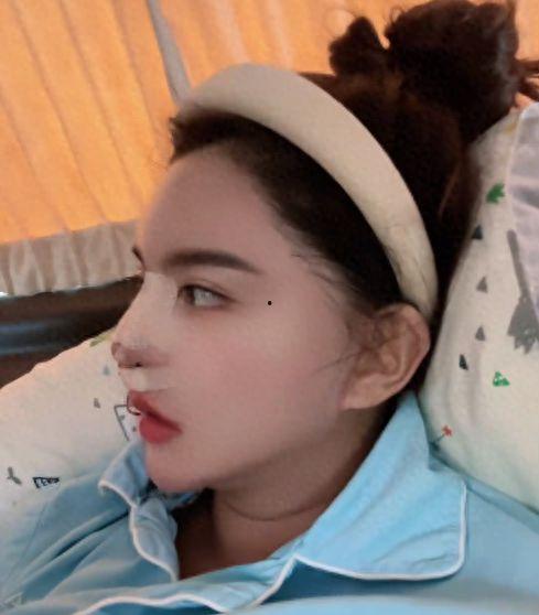 韩安冉最新爆料整形,揭秘最新爆料背后的真相